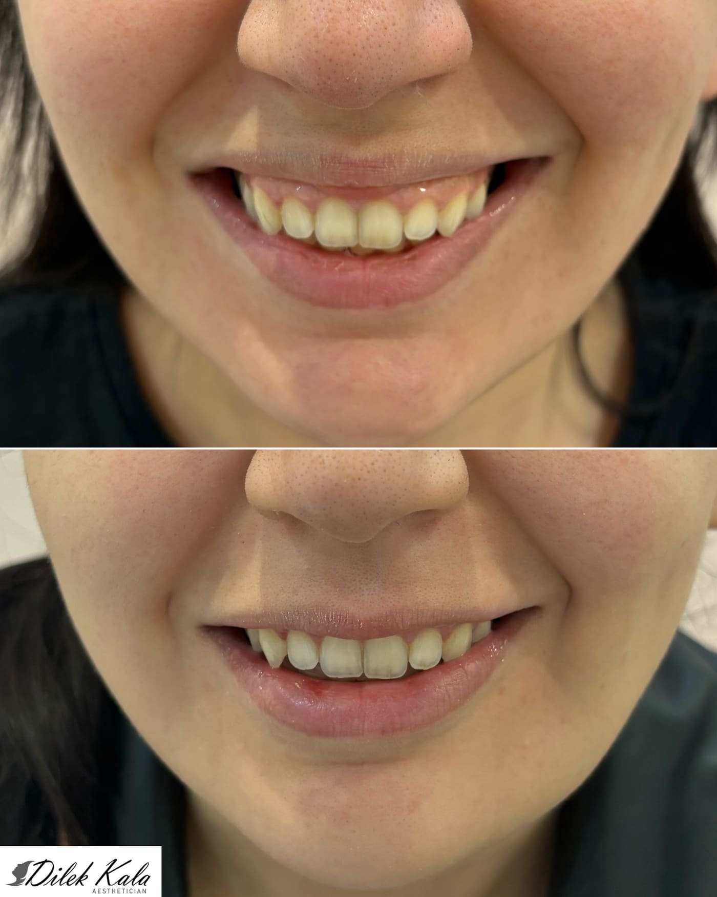 Treatment result 1