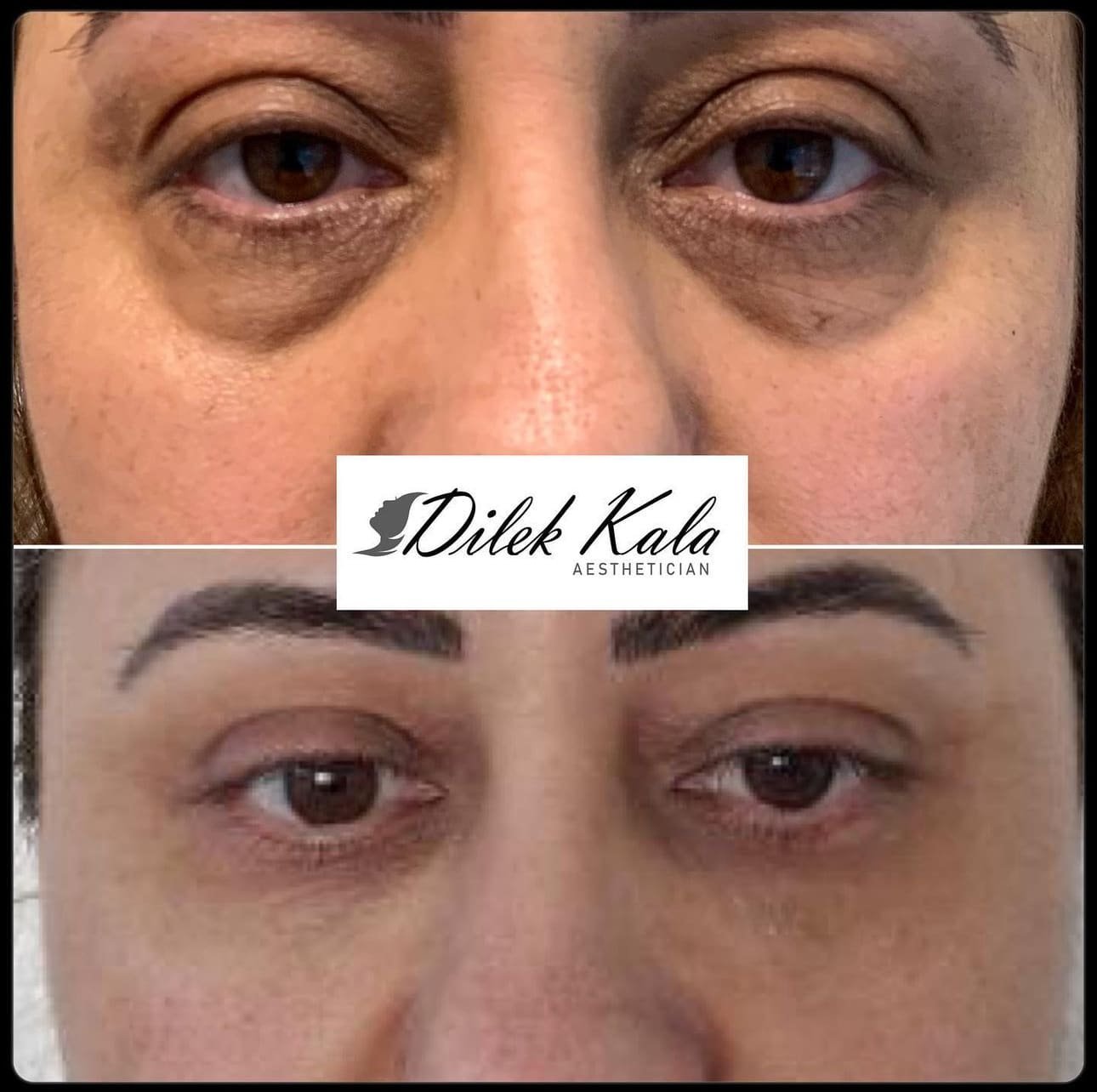 Treatment result 10