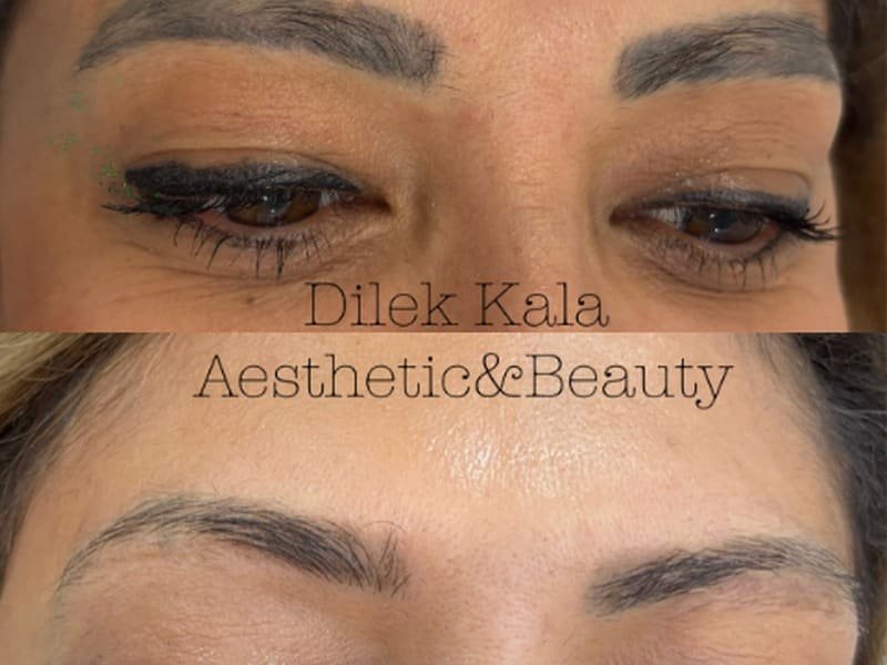 Treatment result 11