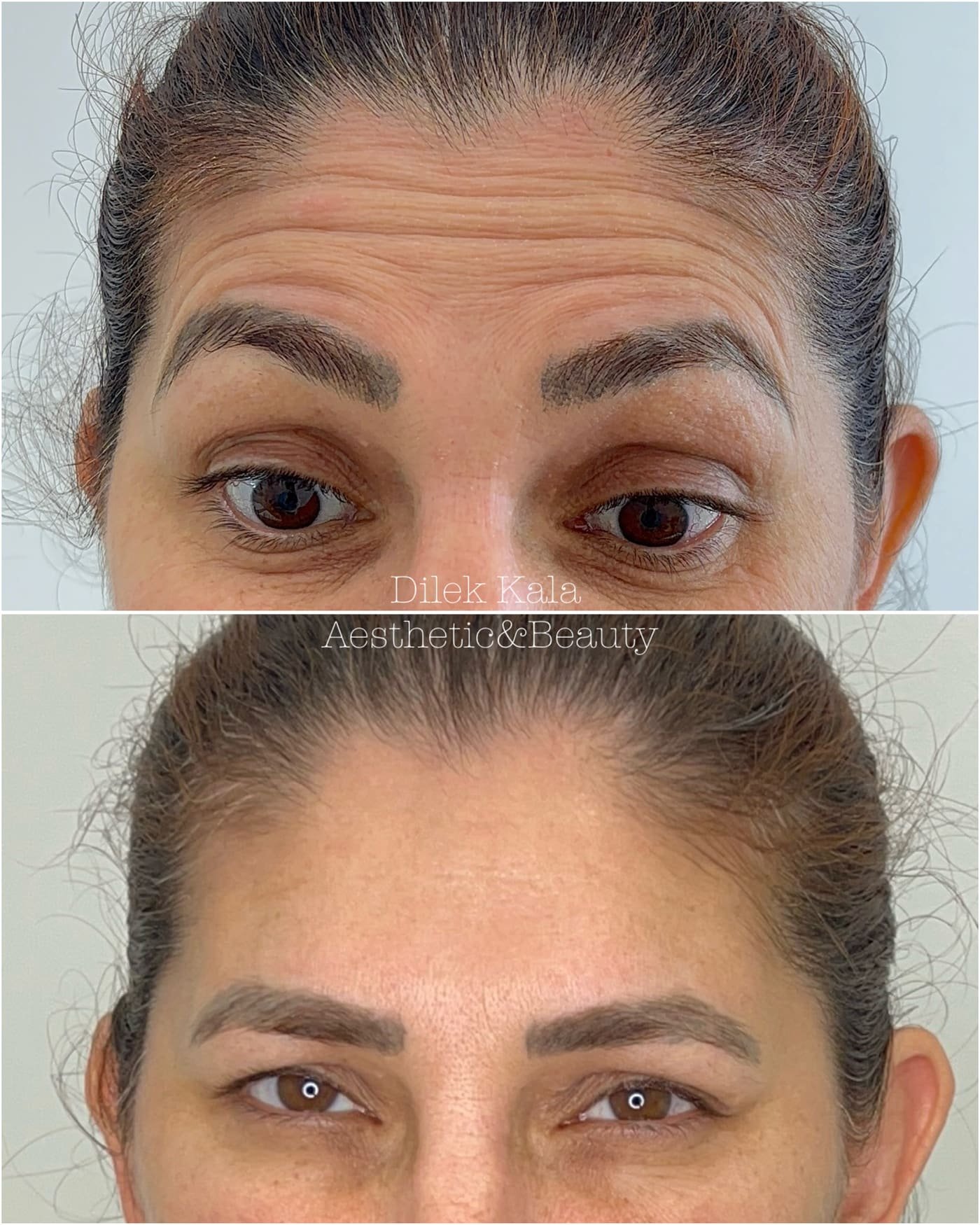 Treatment result 12