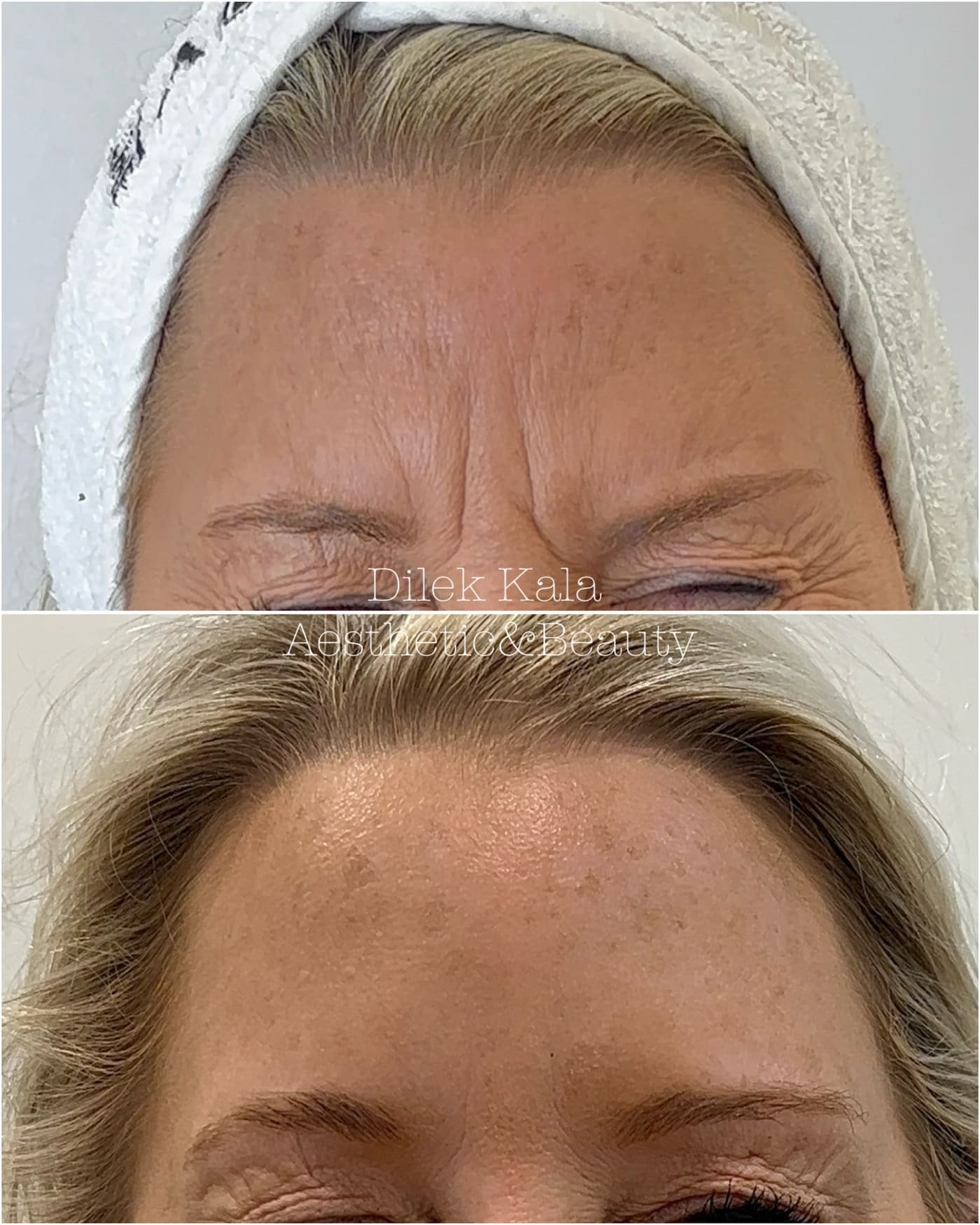 Treatment result 16