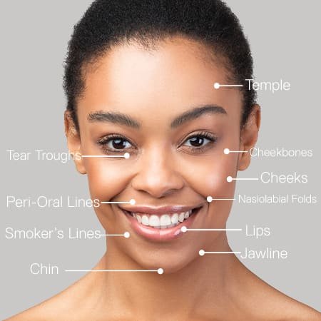 Treatment result 17