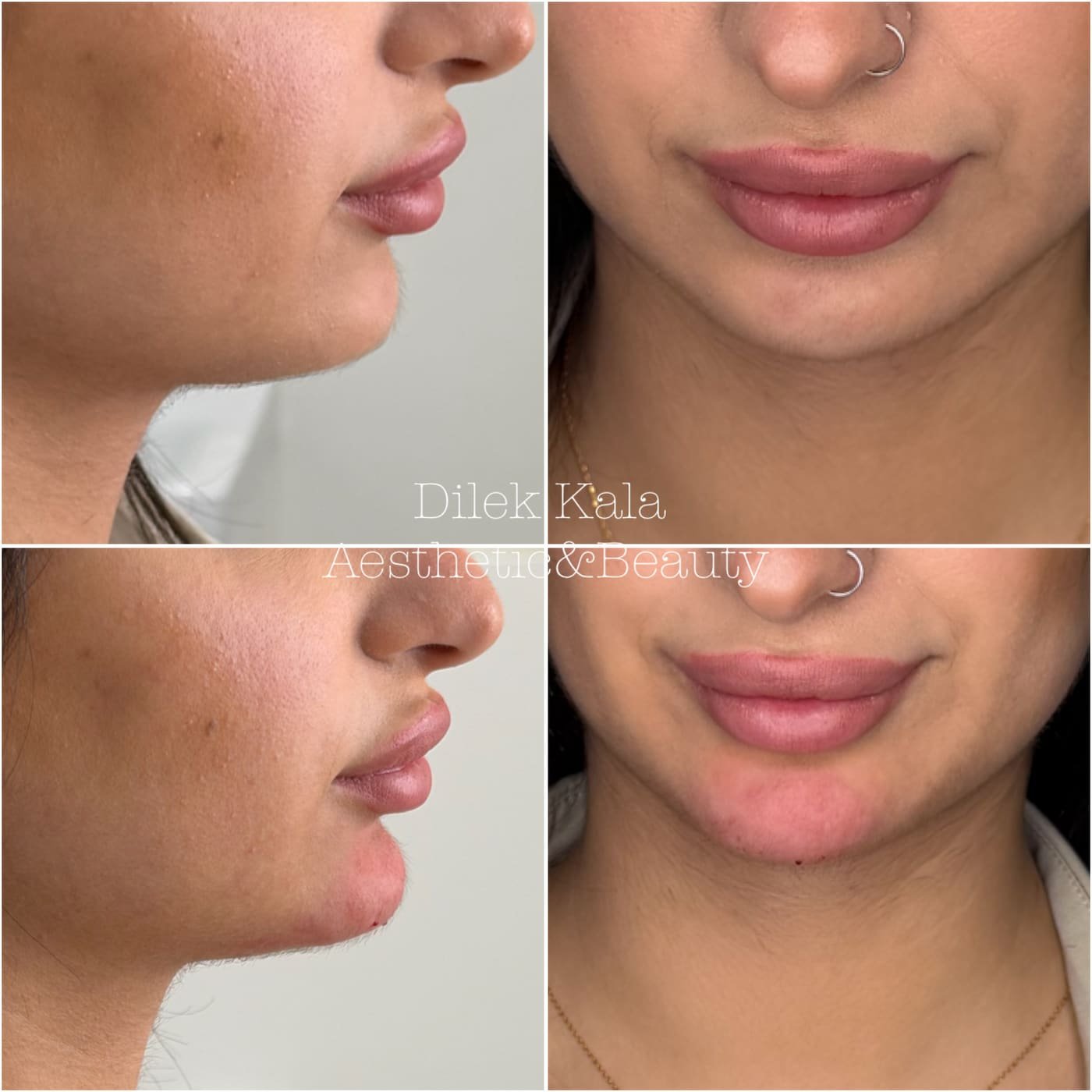Treatment result 20