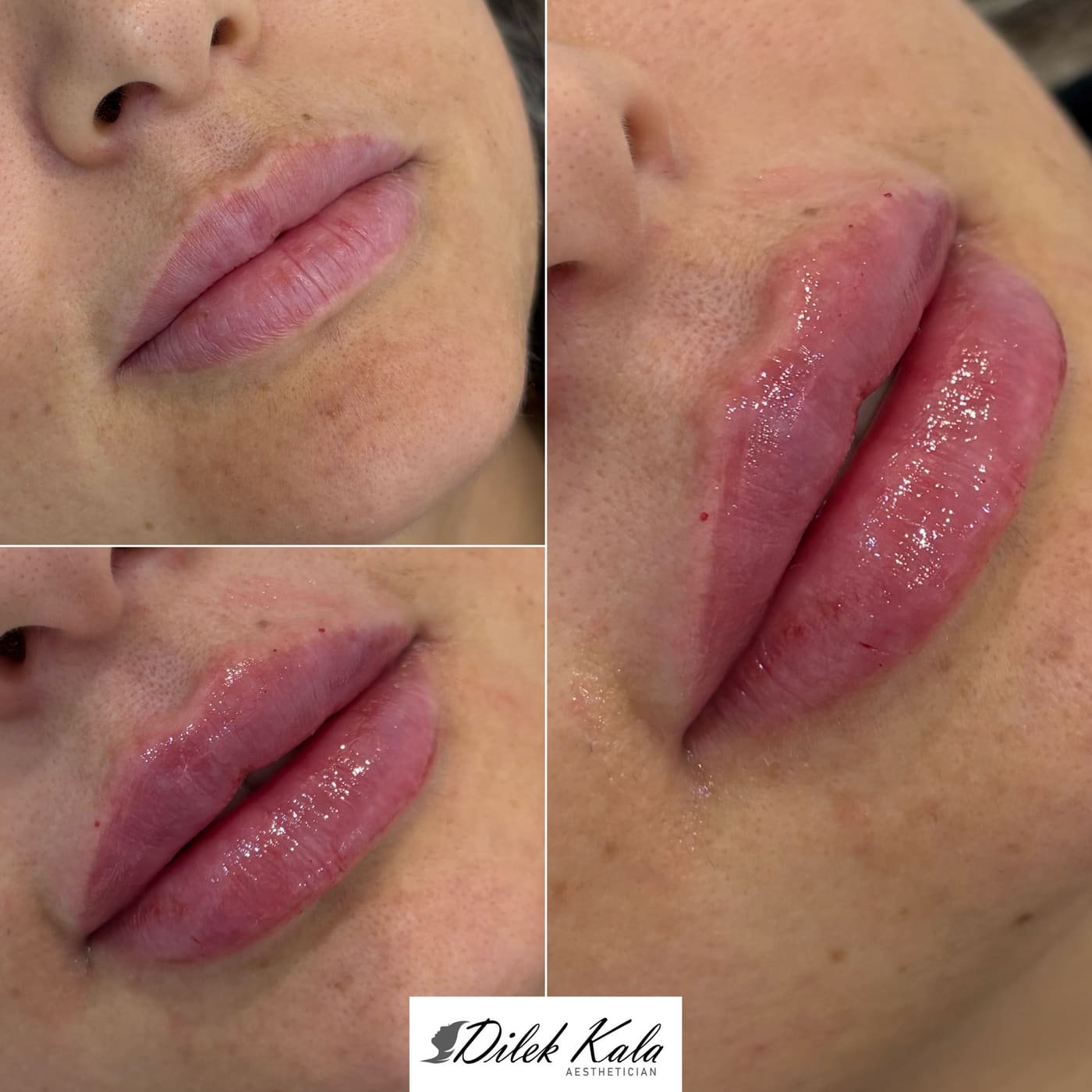 Treatment result 21