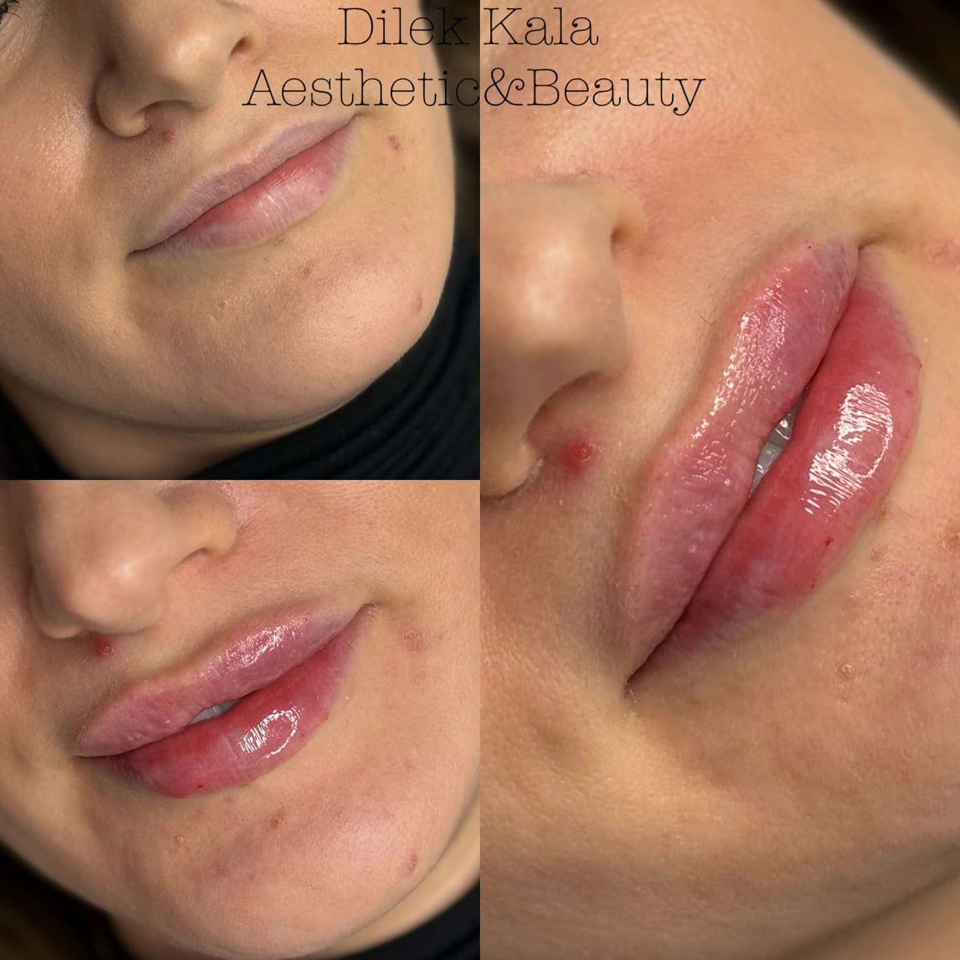 Treatment result 24