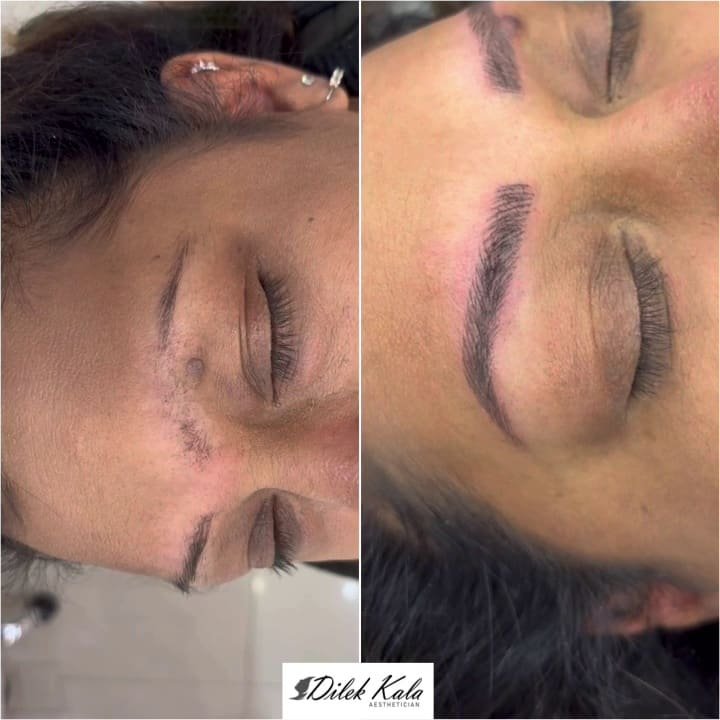 Treatment result 32