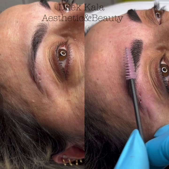 Treatment result 33