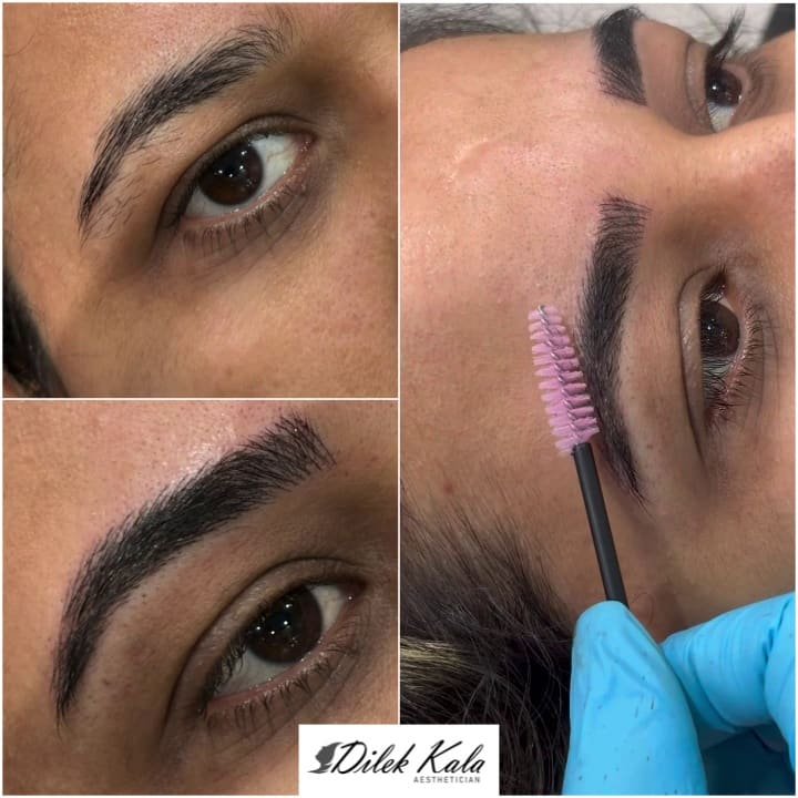 Treatment result 35