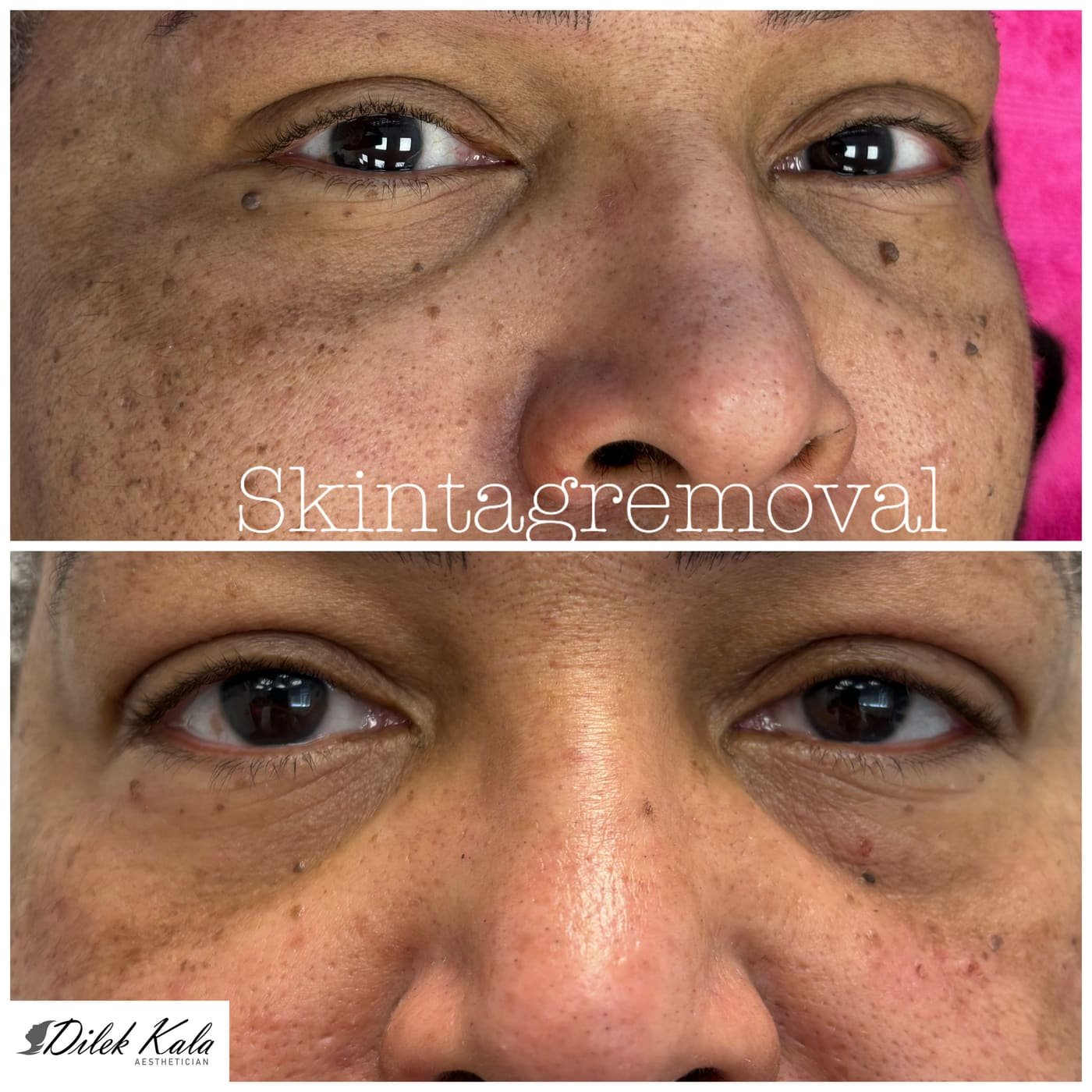 Treatment result 40