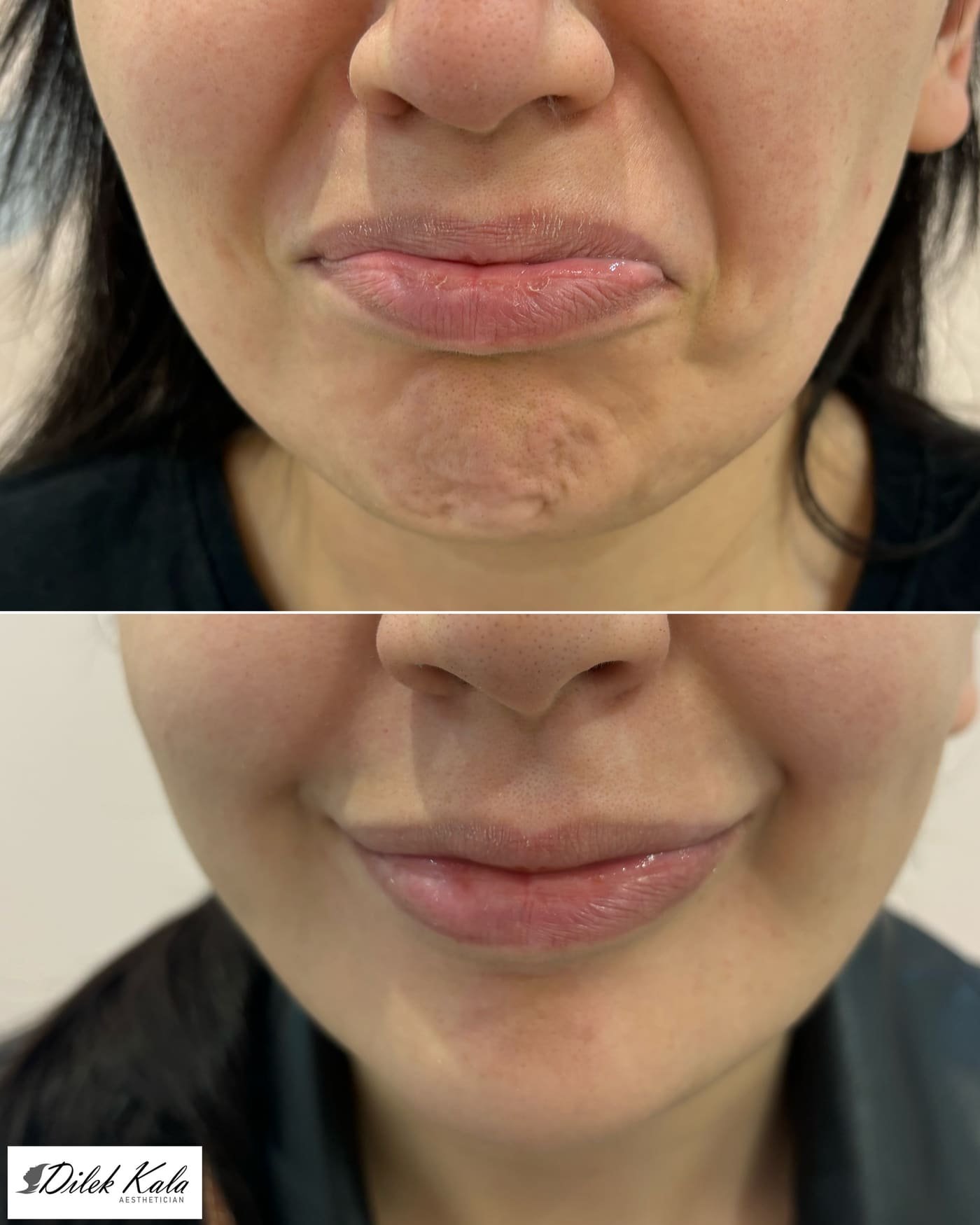 Treatment result 5