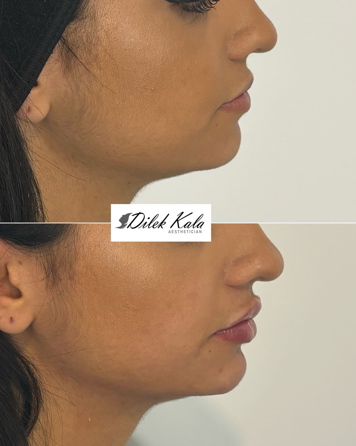 Treatment result 6