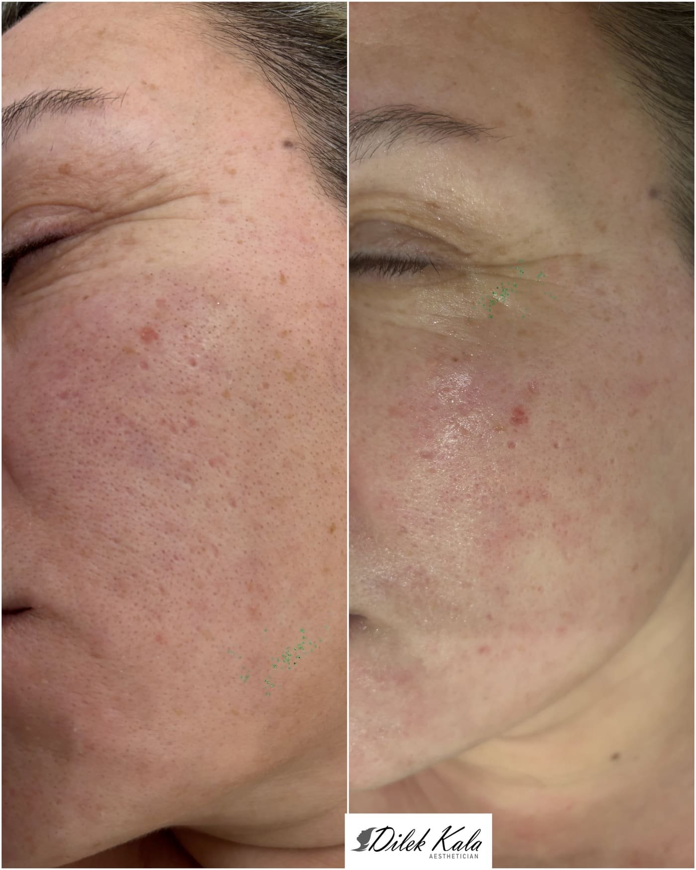 Treatment result 7